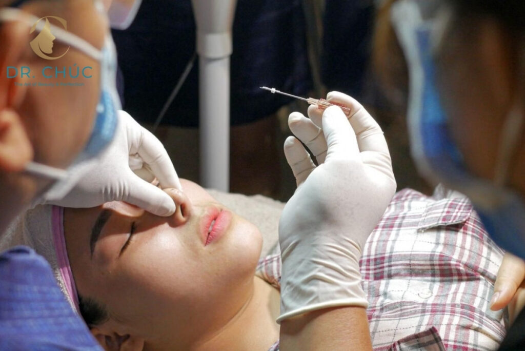 Cơ chế hoạt động của phương pháp nâng mũi bằng chỉ