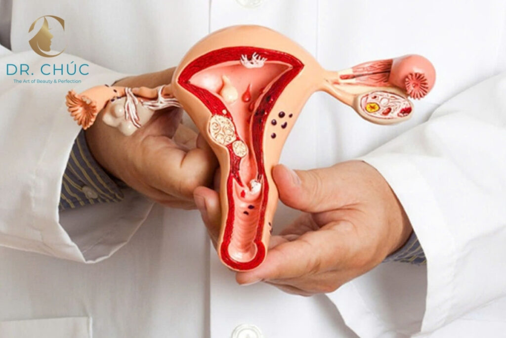 Vì sao phụ nữ cần quan tâm đến thải độc buồng trứng từ sớm?