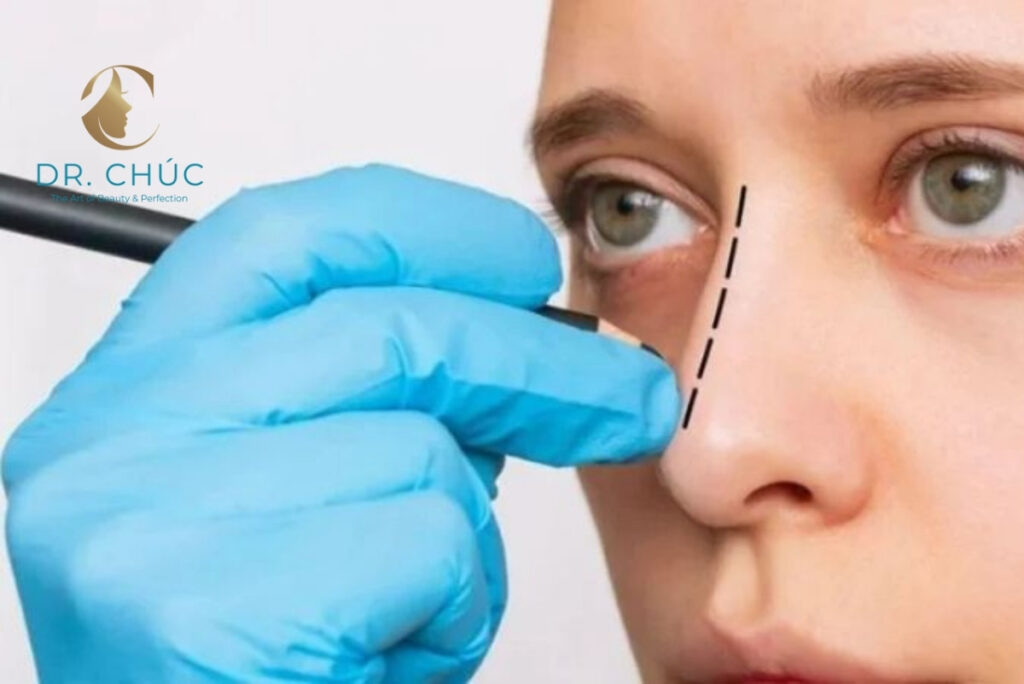 Thu gọn xương mũi bè có đau không?