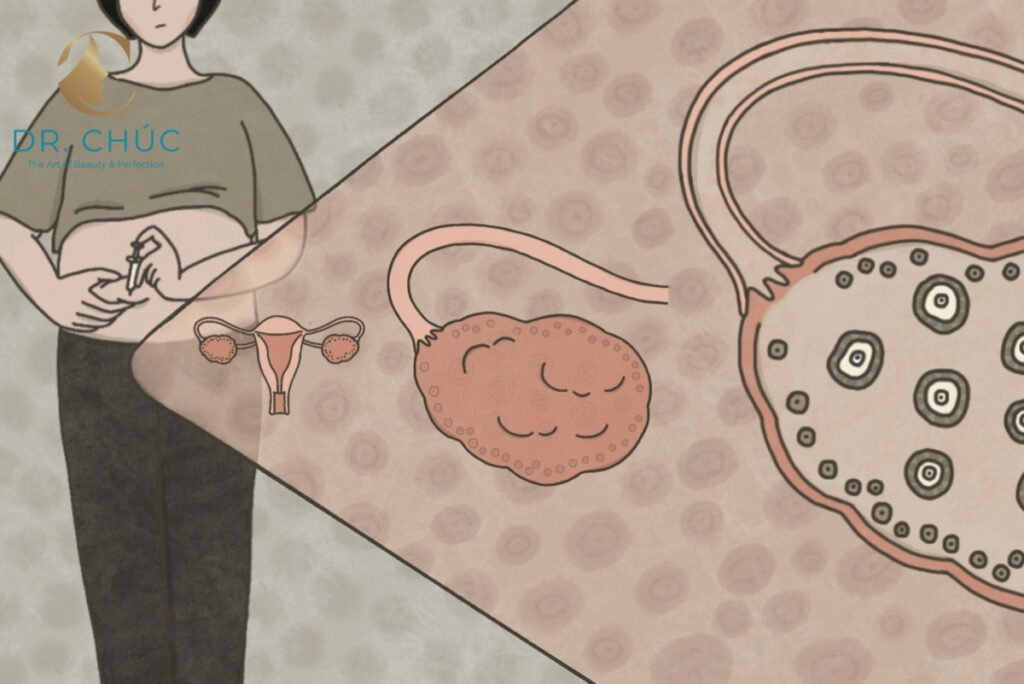 CON SỐ 400 TRỨNG: TRUNG BÌNH THỐNG KÊ, KHÔNG PHẢI ĐỊNH MỆNH