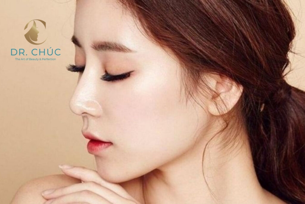 Có nên nâng mũi S-line không?