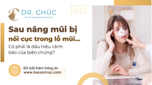 Sau Nâng Mũi Bị Nổi Cục Trong Lỗ Mũi – Dấu Hiệu Cảnh Báo Biến Chứng?