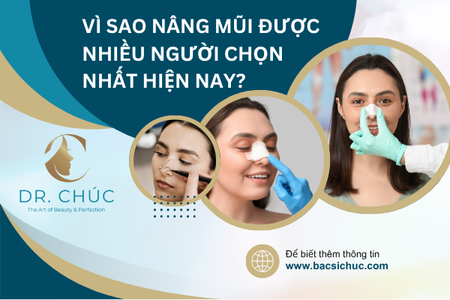 Vì sao nhiều người chọn nâng mũi?
