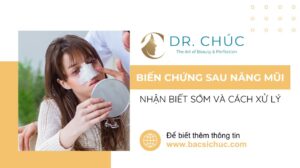 Biến chứng sau nâng mũi: Nhận biết sớm và cách xử lý