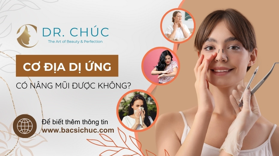Cơ địa dị ứng có nâng mũi được không? Làm sao để tránh phản ứng đào thải?