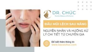Đầu mũi bị lệch sau nâng mũi – Nguyên nhân và hướng xử lý chi tiết từ chuyên gia