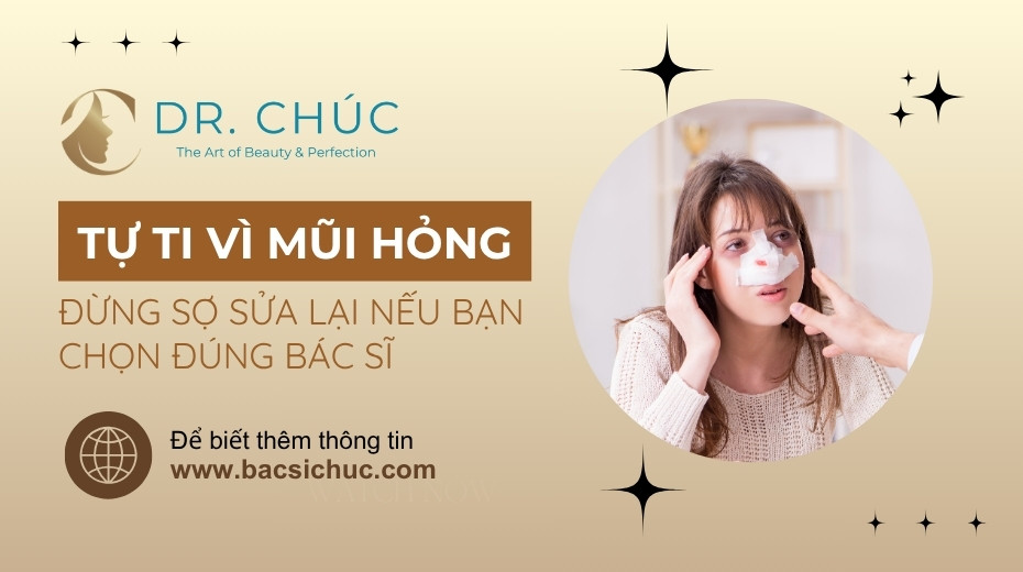 Tự ti vì mũi hỏng? Đừng sợ sửa lại nếu bạn chọn đúng bác sĩ