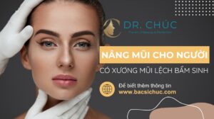 Nâng mũi cho người có xương mũi lệch bẩm sinh: Những điều cần biết