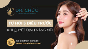 Tự hỏi bản thân 5 điều này trước khi quyết định nâng mũi