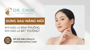 Sưng sau nâng mũi: Khi nào bình thường, khi nào bất thường?