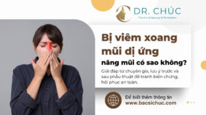 Bị viêm xoang mũi dị ứng nâng mũi có sao không? Tư vấn chuyên sâu từ bác sĩ
