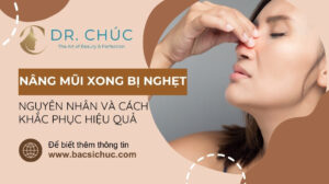 Nâng mũi xong bị nghẹt mũi: Nguyên nhân và cách khắc phục hiệu quả