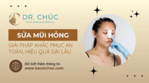 Sửa mũi hỏng: Những điều cần biết trước khi tái phẫu thuật