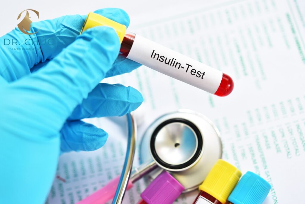 Triệu chứng và dấu hiệu nhận biết kháng insulin