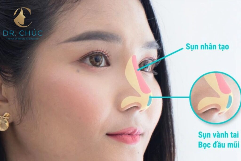 Những yếu tố khách quan ảnh hưởng đến độ bền của mũi