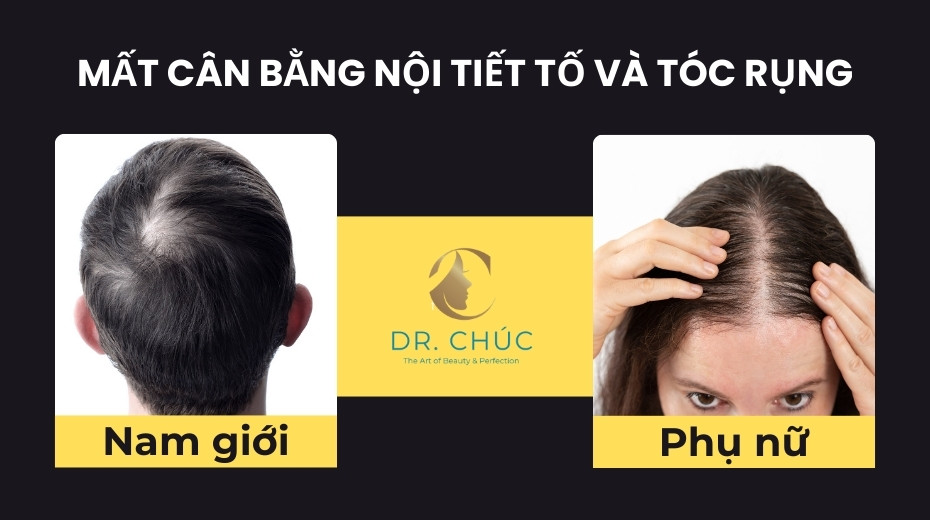 Mất cân bằng nội tiết tố và tóc rụng: Nguyên nhân, giải pháp