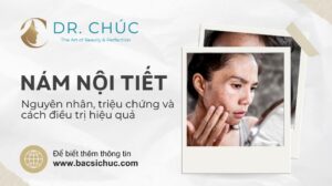 Nám nội tiết: Nguyên nhân, triệu chứng và cách điều trị hiệu quả