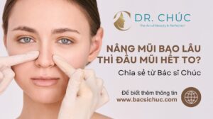 Nâng mũi bao lâu thì đầu mũi hết to? Chia sẻ từ Bác sĩ Chúc