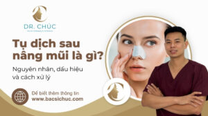 Tụ dịch sau nâng mũi: Nguyên nhân, dấu hiệu và cách xử lý