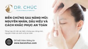 Biến chứng sau nâng mũi: Nguyên nhân, dấu hiệu và cách khắc phục an toàn