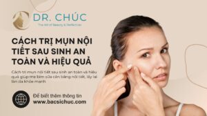 Cách trị mụn nội tiết sau sinh an toàn và hiệu quả