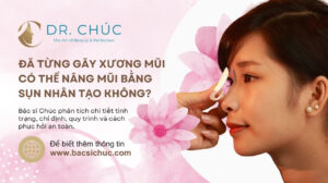 Đã từng gãy xương mũi có thể nâng mũi bằng sụn nhân tạo không?