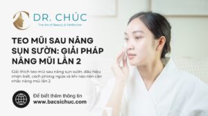 Sự thật về teo mũi sau nâng sụn sườn và giải pháp nâng mũi lần 2