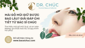 MÀI GỒ MŨI GIỮ ĐƯỢC BAO LÂU? GIẢI ĐÁP CHI TIẾT CHO NGƯỜI MUỐN CẢI THIỆN DÁNG MŨI GỒ