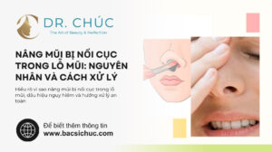 Nâng mũi bị nổi cục trong lỗ mũi: Nguyên nhân và cách xử lý
