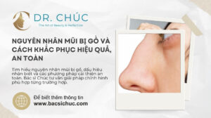 Nguyên nhân mũi bị gồ và cách khắc phục hiệu quả, an toàn