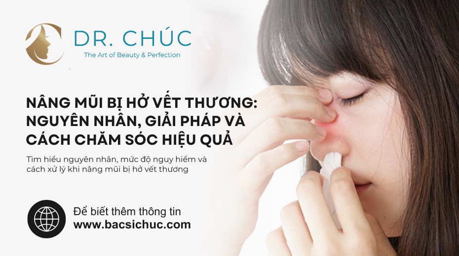 Nâng mũi bị hở vết thương: Nguyên nhân, giải pháp và cách chăm sóc hiệu quả