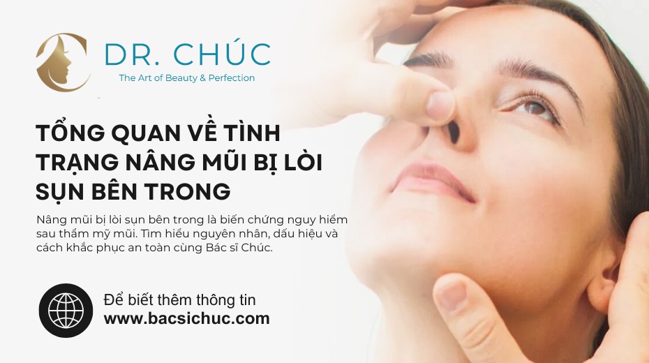 Tổng quan về tình trạng nâng mũi bị lòi sụn bên trong